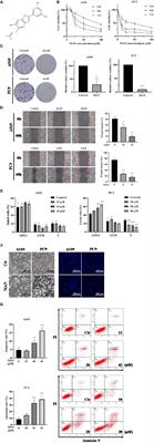 A Novel Benzofuran Derivative Moracin N Induces Autophagy and Apoptosis Through ROS Generation in Lung Cancer